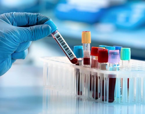 hematologie-casablanca-laboratoire